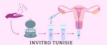 fécondation in vitro tunisie